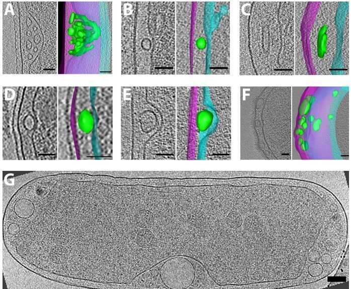 electron cryotomography